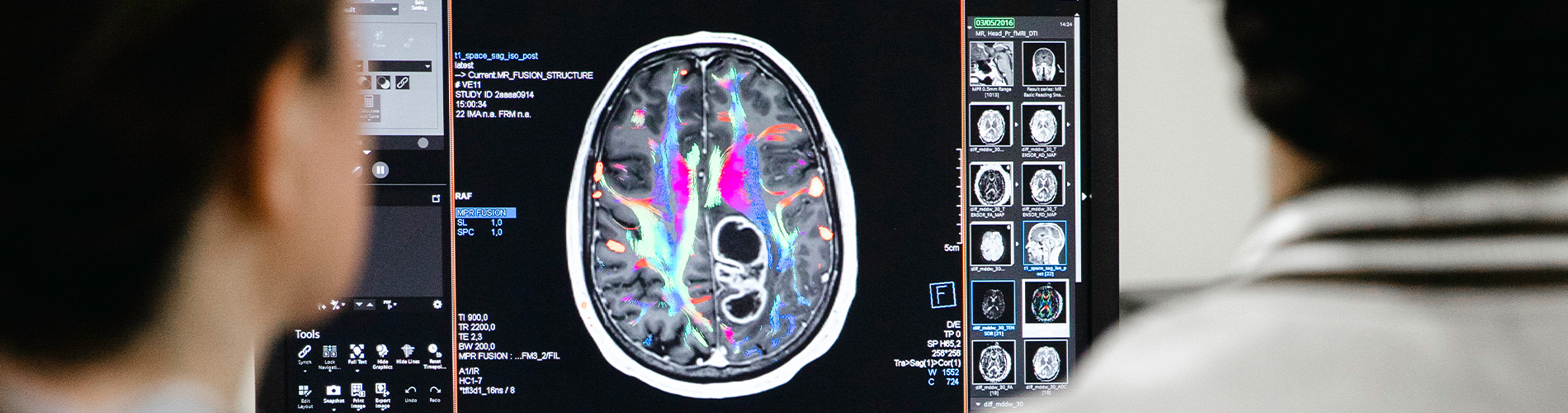 Licenciatura em Imagem Médica e Radioterapia